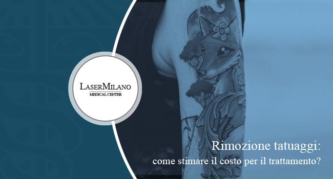 costo rimozione tatuaggi centro Laser Milano