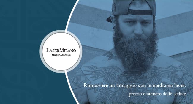 Rimozione tatuaggi 2018 Laser Milano costo