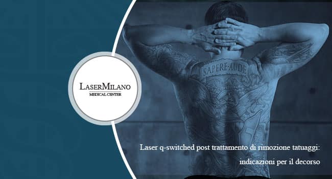 Laser q-switched usato per la rimozione tatuaggi